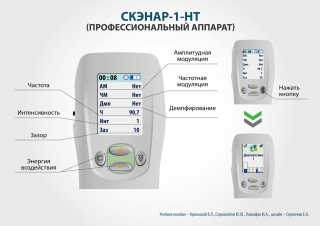 СКЭНАР-1-НТ (исполнение 01)  в Коврах купить Скэнар официальный сайт - denasvertebra.ru 
